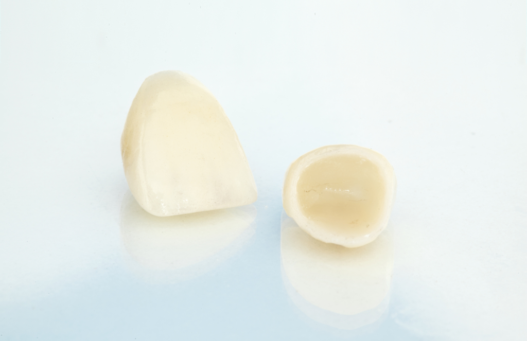 everything you need to know before getting a dental crown
