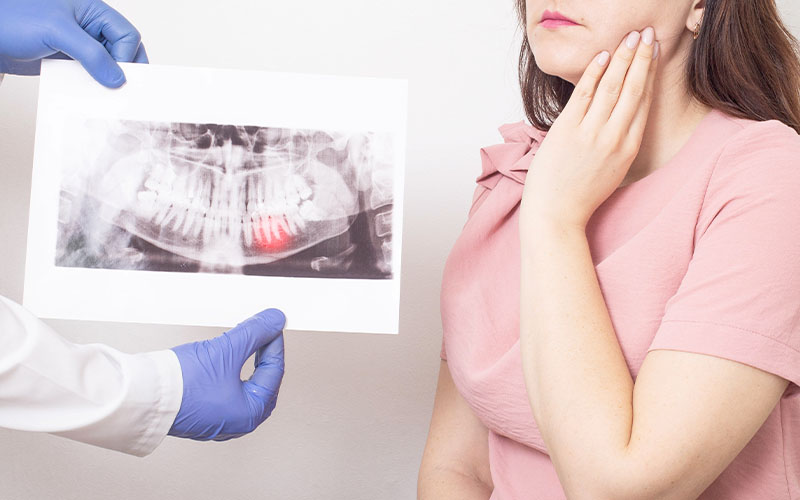 Griesbach Dental - Dentist holding an X-ray of their patients wisdom teeth